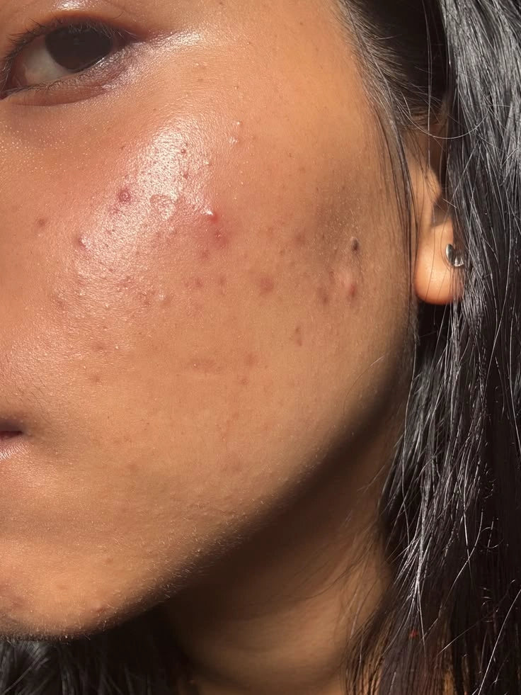 Breakouts With No Clear Cause