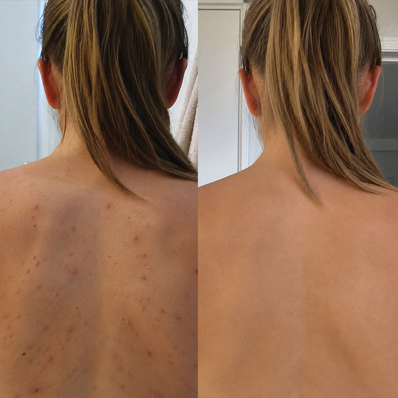 Better for your skin