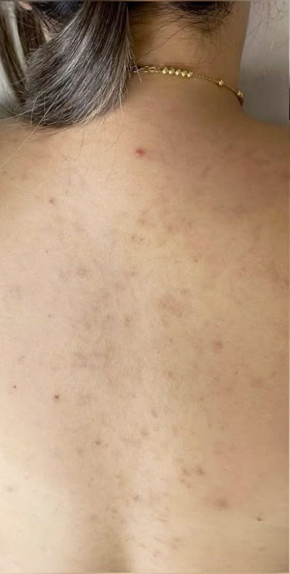 Less irritated skin na